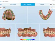 Align Technology wprowadza innowacje wspierające lekarzy dentystów w lepszym zrozumieniu potrzeb pacjentów, zwiększeniu akceptacji leczenia oraz efektywniejszym zarządzaniu praktyką