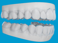 Align Technology prezentuje nowe innowacje ortodontyczne wspierające planowanie leczenia Invisalign®, wizualizację jego efektów i zaangażowanie pacjentów