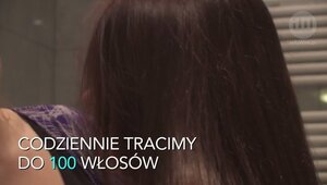 Polacy łysieją na potęgę. To efekt stylu życia