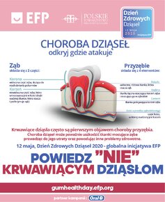 infpgrafika_choroba dziąseł_gdzie atakuje.jpg