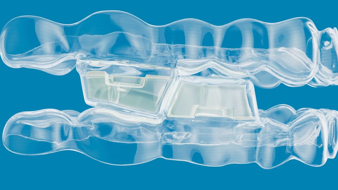 System Invisalign® Mandibular Advancement z blokami okluzyjnymi