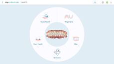 large-jpg-itero-lumina-pro_-aohs-hub-screen-jpg