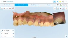 aohs_gum-health_gumlines1-png