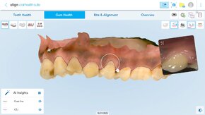 AOHS_Gum Health_Gumlines1.png