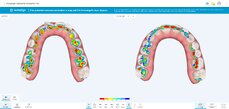 occlusogram-in-iosim-pro-png