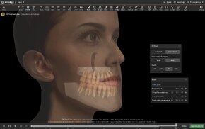 3D Tissue Animation.png