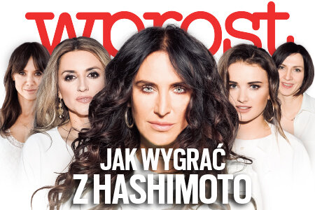 "Wprost"(34) Jak wygrać z Hashimoto